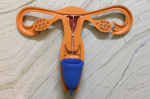 menstrual cup and iud. Discover the safety considerations of using a menstrual cup and IUD or copper T. Learn how to minimize risks and ensure a comfortable experience.