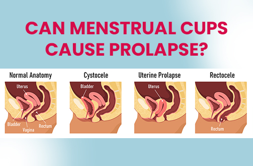 pelvic organs, female reproductive system, vagina diagram,menstrual cups cause prolapse