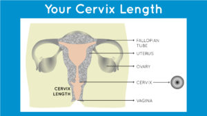 How to Measure Cervix Length at Home, How to measure cervix length for menstrual cup